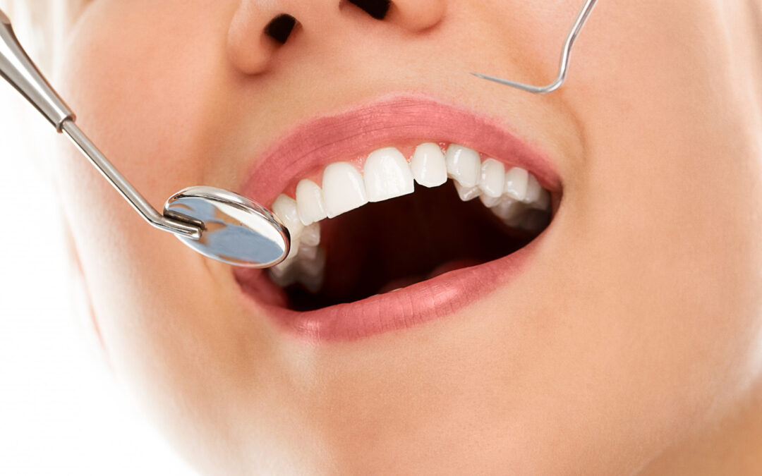 Prevenzione dentale con la Fluoroprofilassi - Dentista Roma