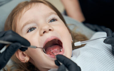 Prima visita dal dentista: come rendere positiva l’esperienza per i bambini