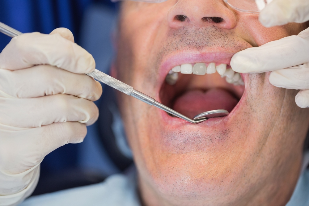 Dente annerito: ecco tutto quello che può fare un dentista